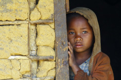 «غرب ووسط إفريقيا» تضم 20% من حالات التقزم في العالم