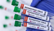 إيطاليا تبدأ حملتها للتطعيم ضد جدري القردة