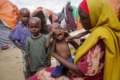 حفارو القبور بالصومال يدفنون أطفالاً هربوا من الجوع لكنه "تبعهم"
