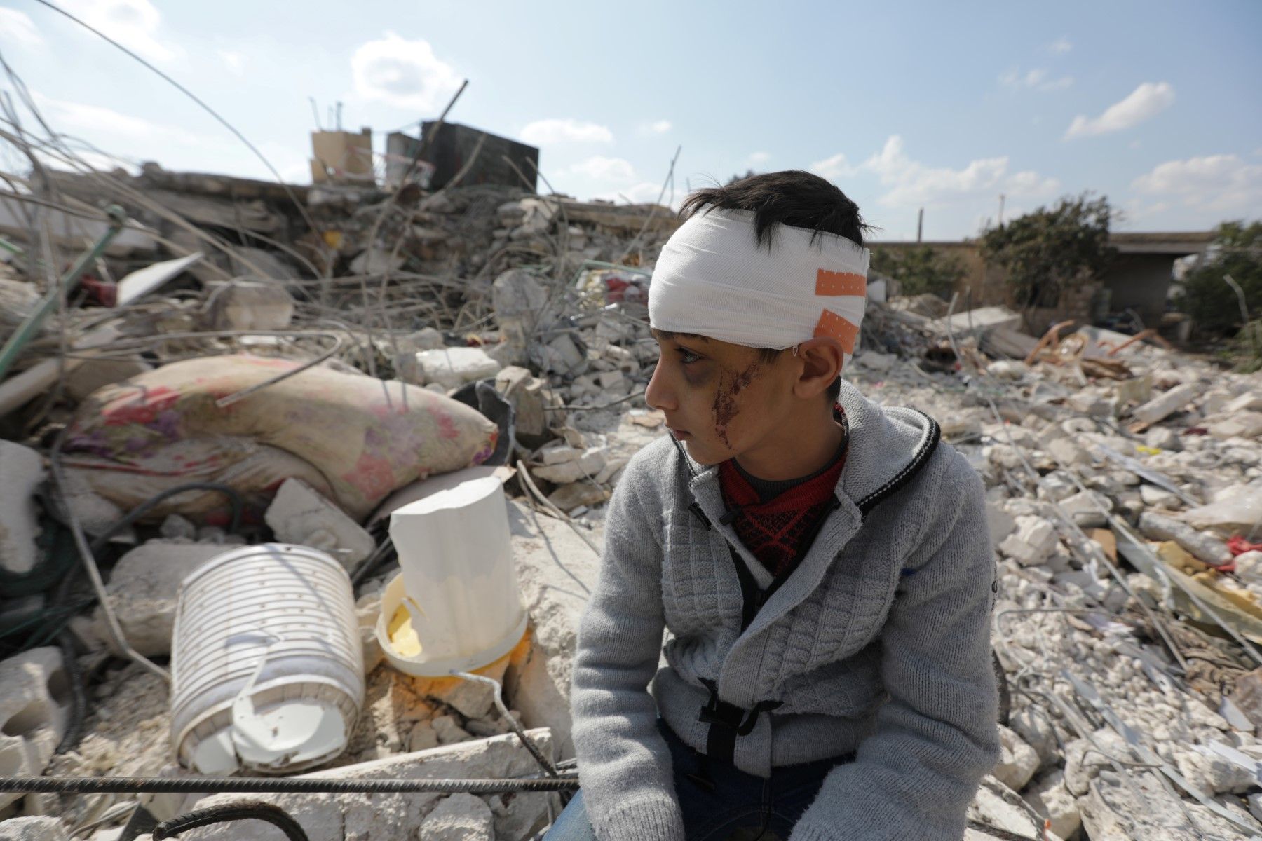 A Syrian boy who lost his family and also wounded in the deadly Turkey- Syria earthquake looks sadly at the ruins of the city/ AFP