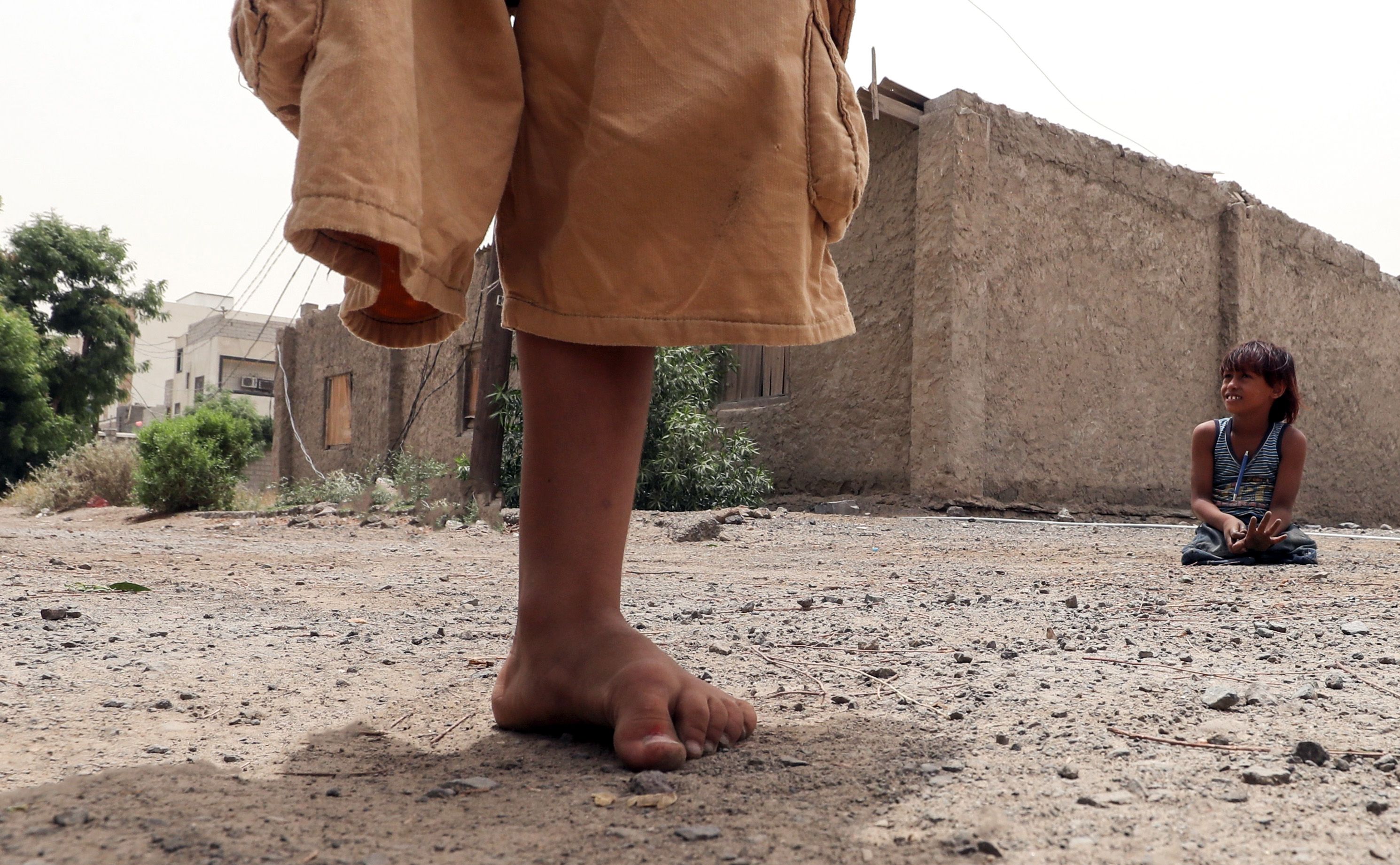  Yemeni children whose legs were amputated after they were injured by landmines playing in the country's second city of Aden/ AFP