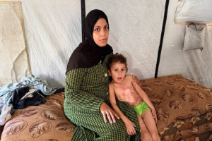 وسط الدمار والركام.. ريتال طفلة من ضحايا الحرب على غزة تحلم بالعلاج