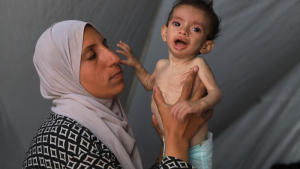 غزة بين أنياب الجوع ونيران القصف.. حين يتحول الحصار إلى سلاح إبادة صامتة