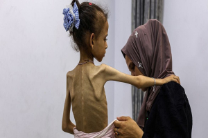 الأمم المتحدة: مليون امرأة وفتاة يواجهن خيارات مستحيلة بين الجوع والموت