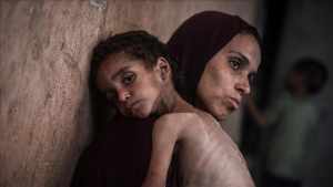 حين تنهار المناعة أمام الحرب.. "متلازمة الشلل" تضرب أطفال غزة المحاصرة
